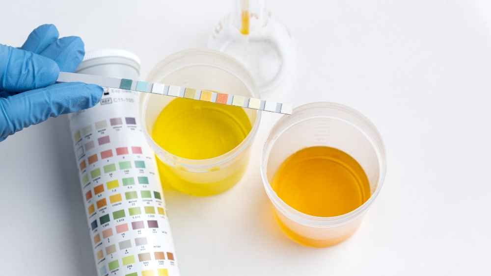 Monitor Your Urine Color