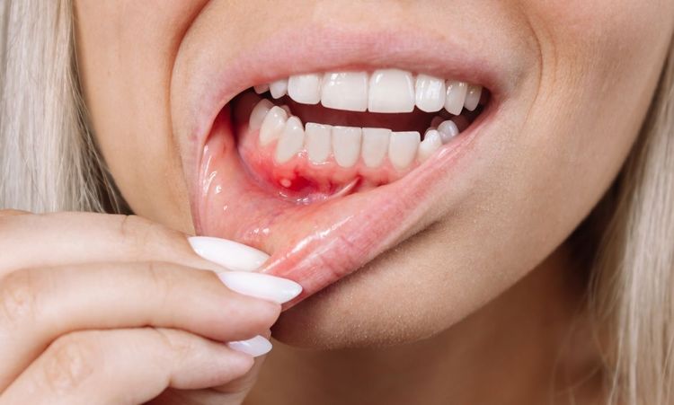 What Causes Gum Disease and How You Can Resist It